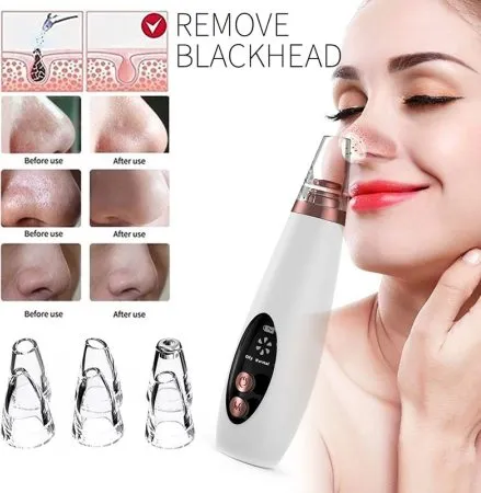 Blackhead Remover Instrument Black Dot Remover Acne Vacuum Suction Face Clean Black Head Pore Cleaning Beauty Skin Care Tool - Black Head Remover - Darma Roller - Image 3