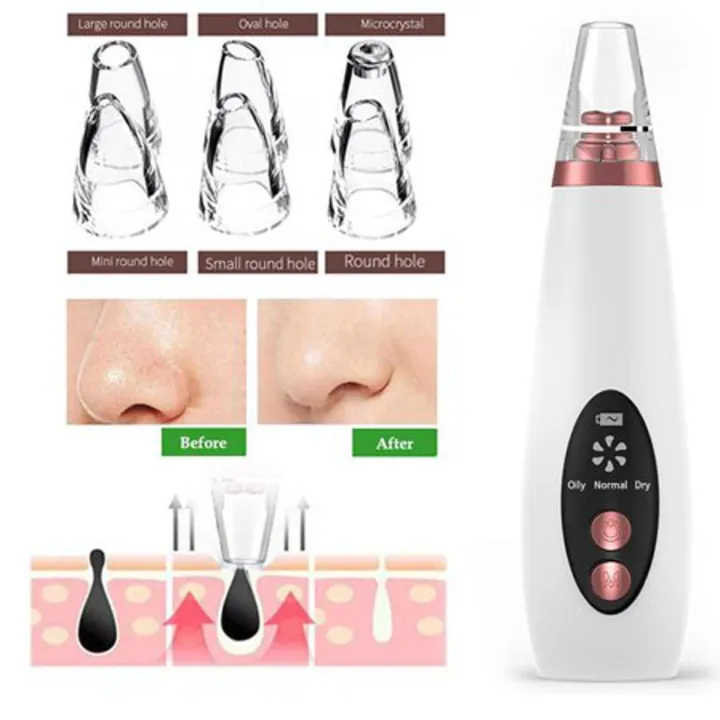 Blackhead Remover Instrument Black Dot Remover Acne Vacuum Suction Face Clean Black Head Pore Cleaning Beauty Skin Care Tool - Black Head Remover - Darma Roller - Image 4